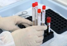 Тестирование на COVID-19 приостановили в центрах экспертизы 5 городов РК коронавирус тест анализ