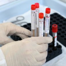 За прошедшие сутки зарегистрировано 5 317 новых случаев заболевания коронавирус тест анализ