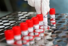 Эпидемиологическая ситуация по коронавирусной инфекции в Шымкенте коронавирус