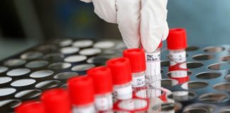 В Шымкенте зарегистрировано 4 случая заражения коронавирусной инфекцией коронавирус