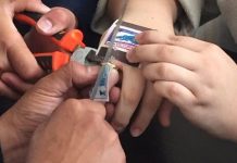 Спасатели помогли жительнице Шымкента снять кольцо с опухшего пальца снимают кольцо