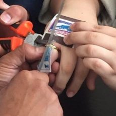 Спасатели помогли жительнице Шымкента снять кольцо с опухшего пальца снимают кольцо