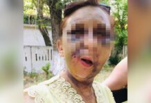 В Шымкенте жестоко избили и пытались убить мать двоих детей жертва насилие