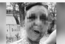 Женщине из Шымкента, которую зверски избили, нужна срочная операция избитая женщина