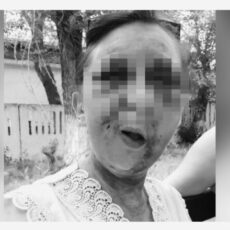 Женщине из Шымкента, которую зверски избили, нужна срочная операция избитая женщина