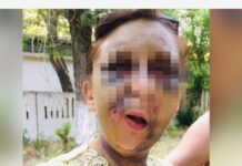 В Шымкенте госпитализировали женщину, которая была жестоко избита избитая женщина