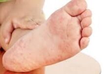 У детей в Шымкенте не выявлено синдрома Кавасаки