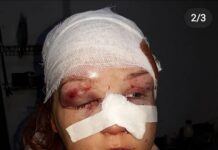 По факту жестокого избиения жительницы Шымкента проводится расследование жертва избиения