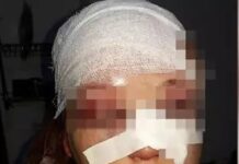 Избил жену молотком: Что грозит мужчине за избиение