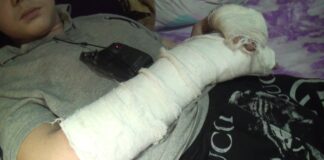 В Шымкенте водитель на «Мерседесе» сбил подростка и скрылся с места ДТП