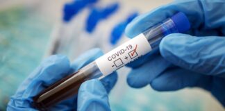 6 апреля в Шымкенте зарегистрировано 72 случая заражения КВИ коронавирус