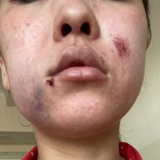 В Ленгере бывший муж избил жену на глазах у маленького сына избил жену