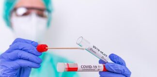 За прошедшие сутки признаки заболевания КВИ в Шымкенте обнаружены у 74 человек коронавирус