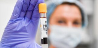 В Шымкенте с начала года зарегистрировано 512 случаев пневмонии коронавирус