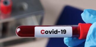 На 13 июня в Шымкенте зарегистрировано 42 случая КВИ коронавирус