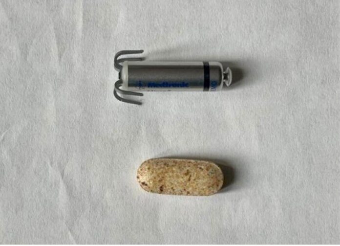 имплантация электрокардиостимулятора