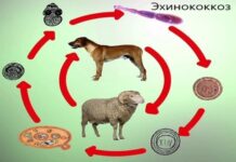 В Шымкенте за 8 месяцев зарегистрировано 48 случаев эхинококкоза Эхинококкоз
