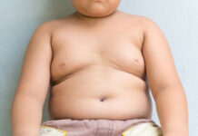 Каждый пятый казахстанский подросток страдает ожирением