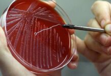 Профилактика сибирской язвы в Шымкенте и контроль за очагами сибирская язва