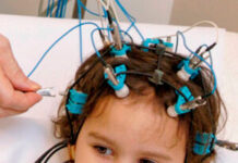 В Шымкенте дети с эпилепсией остро нуждаются в дорогостоящих медикаментах эпилепсия