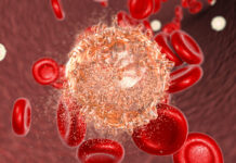 Детей с лейкемией будут лечить в Шымкенте