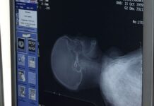 Компьютерный томограф появился в первой городской больнице