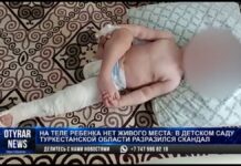 Из детского сада прямиком на операционный стол. Ребенок в Туркестанской области получил травмы