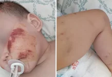 Ребенка сбила машина возле детского сада в Туркестанской области