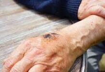 Появились подробности заражения сибирской язвой