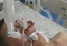 Мужчина впал в кому после группового избиения в Шымкенте