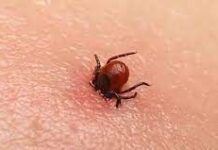 Конго-Крымскую лихорадку подтвердили в Шымкенте