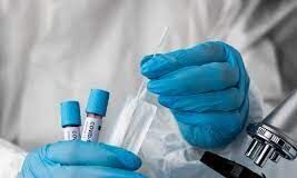 105 заболевших COVID-19 выявили за сутки в Шымкенте