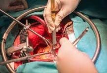 «Потерял много крови»: Тяжело раненного в кафе мужчину прооперировали