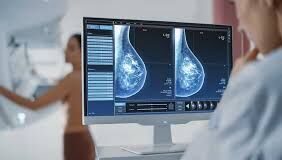 Онкомаммологи Шымкента проведут бесплатные консультации