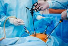 Впервые шымкентские хирурги удалили кисту в почке без разреза Лапароскопия