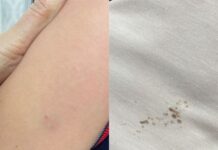 Учительница проткнула шариковой ручкой руку пятиклассника в Шымкенте