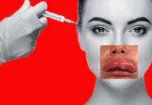 Осторожно! От лже-косметологов пострадали 6 жительниц Шымкента