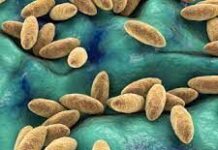 В Шымкенте бруцеллезом заразился 21 человек, из них 3 — дети