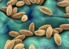 В Шымкенте бруцеллезом заразился 21 человек, из них 3 — дети