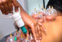 Шымкентские врачи предупреждают об опасностях кровопускания хиджамы