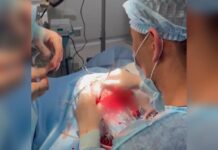 Врачи извлекли червей из мозга 10-летнего ребенка в Шымкенте