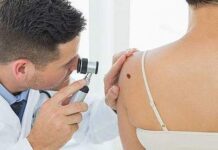 В Шымкенте ведущие онкодерматологи проведут бесплатные консультации