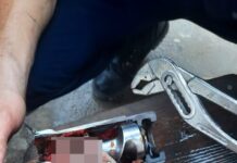 В Шымкенте у ребенка застряла рука в мясорубке