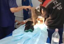 Ребенок в Шымкенте потерял три пальца, случайно засунув руку в мясорубку