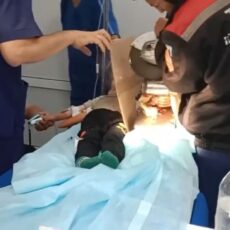 Ребенок в Шымкенте потерял три пальца, случайно засунув руку в мясорубку