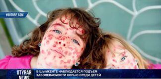 Эпидемия кори в Шымкенте?
