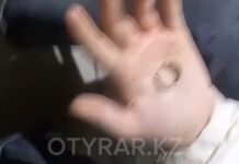 Снять кольцо с пальца девочки помогли спасатели в Шымкенте