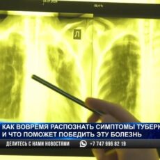 В Шымкенте наблюдается увеличение заболеваемости туберкулезом