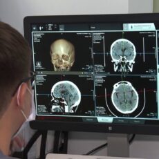 Cerebra AI: как технологии сокращают время диагностики инсульта