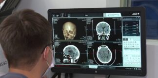 Cerebra AI: как технологии сокращают время диагностики инсульта